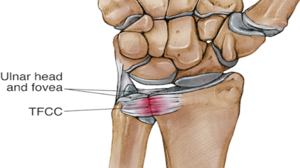 Physiotherapy Sydney: Reduce Pain & Restore Movement