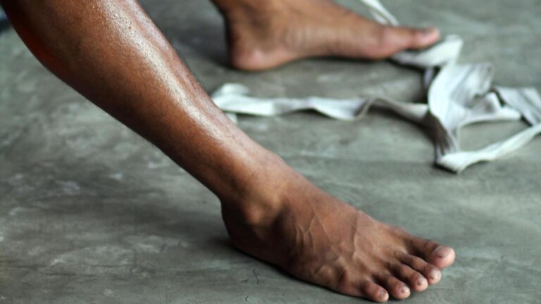 Ankle Sprains - iMove Physio Guide