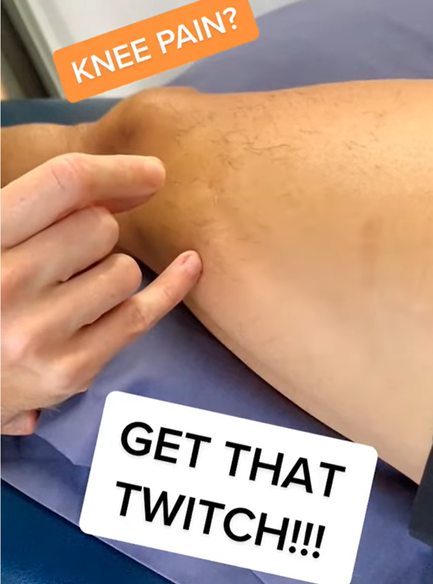 Dry needling knee pain